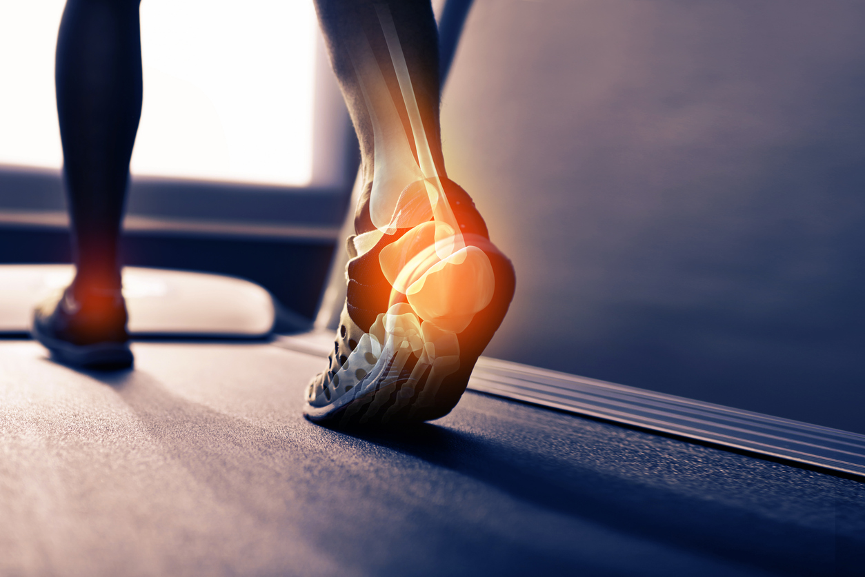 Achilles Tendon Injury
